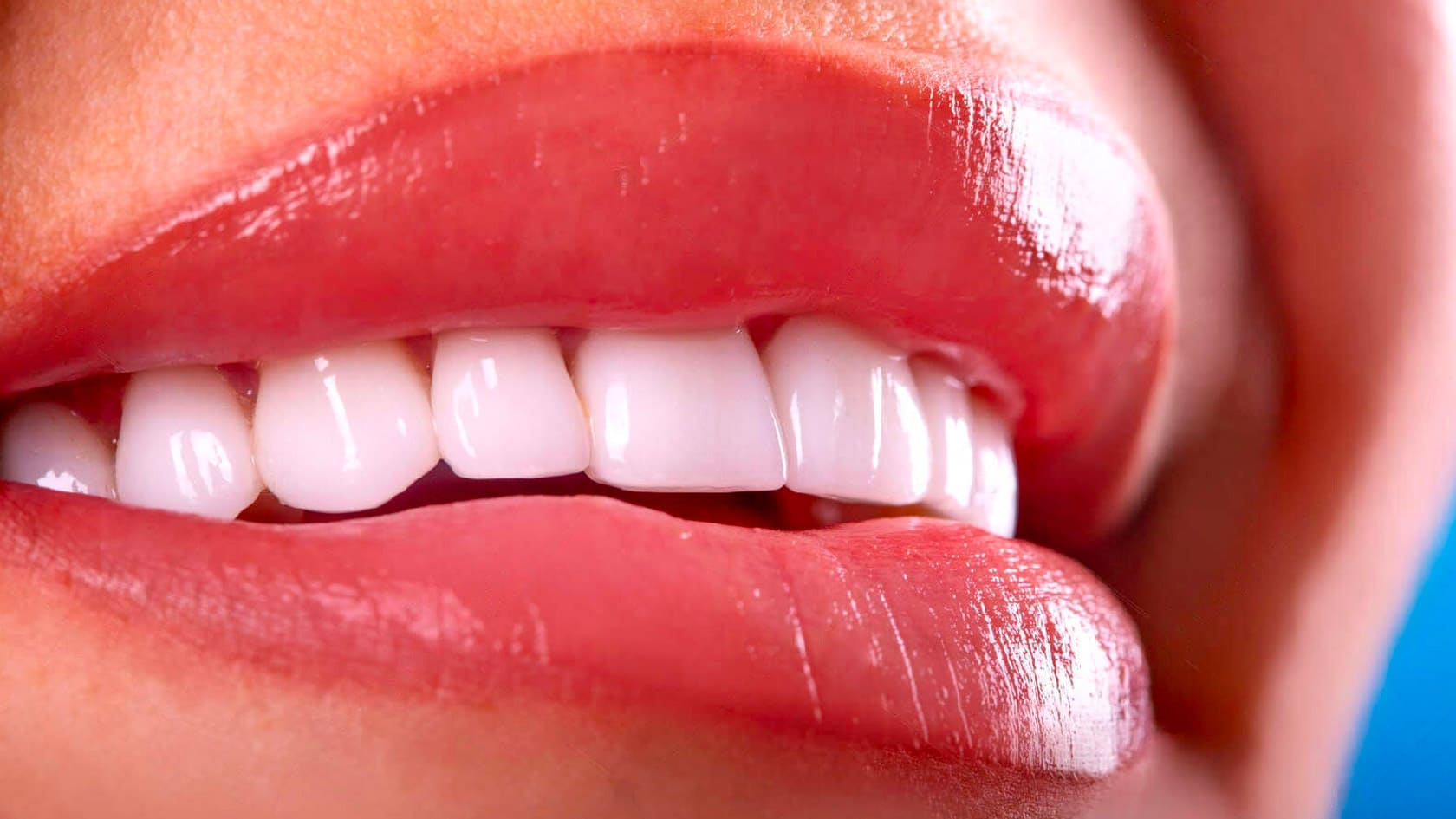 Diş beyazlatmanın etkisi ne kadar sürer?
