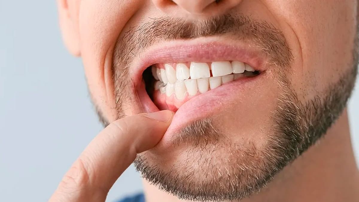 Diş eti hastalıklarının başlıca belirtileri nelerdir?