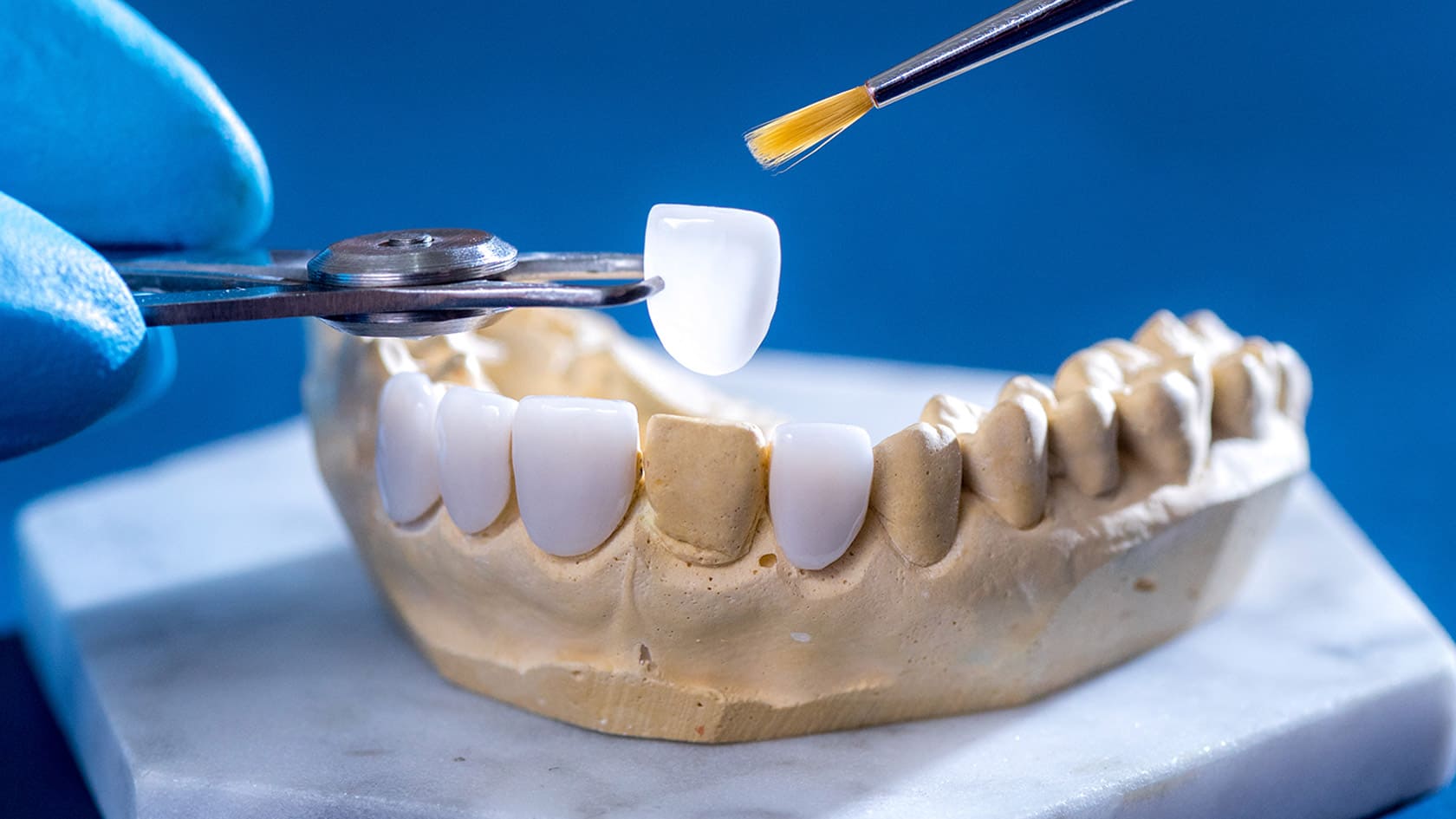 Zirkonyum Diş Kaplamalarının Özellikleri Nelerdir?
