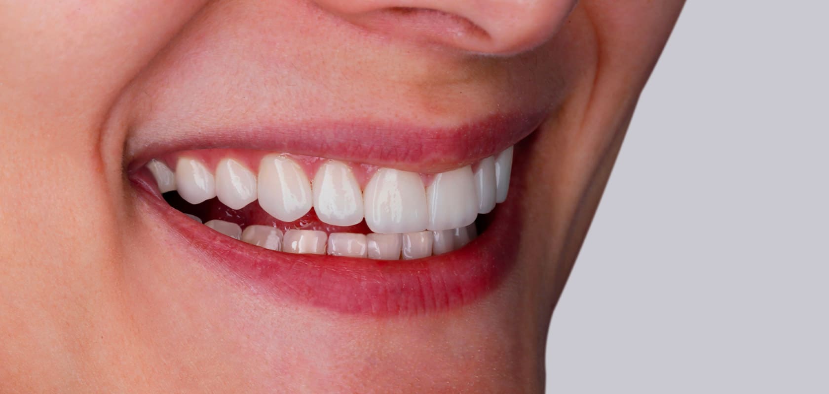 Zirkonyum Diş Kaplama nedir?